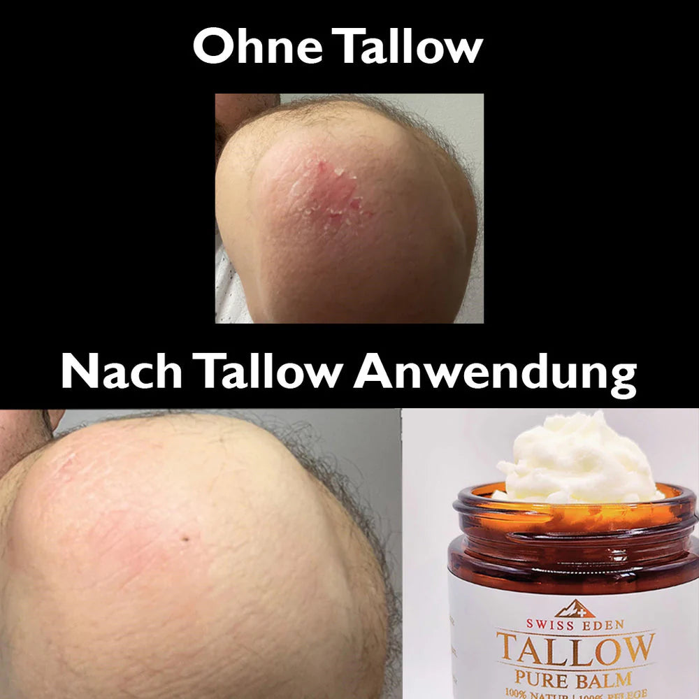 Kundenbild mit Pflege-Erfahrung nach Anwendung von Swiss Eden Tallow Vanille & Honig.